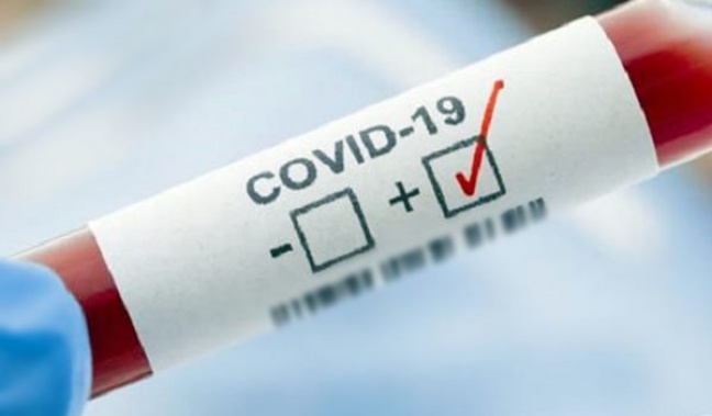 Testów na COVID-19 wykonujemy zdecydowanie za mało