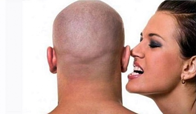 Transplantacja włosów coraz popularniejsza wśród łysych.