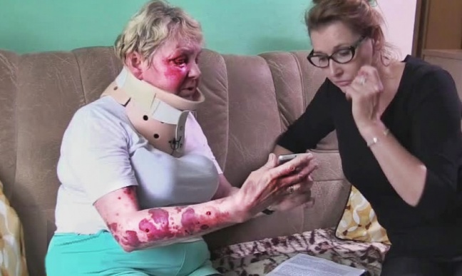 Emerytka obezwładniona i pobita przez policjanta.